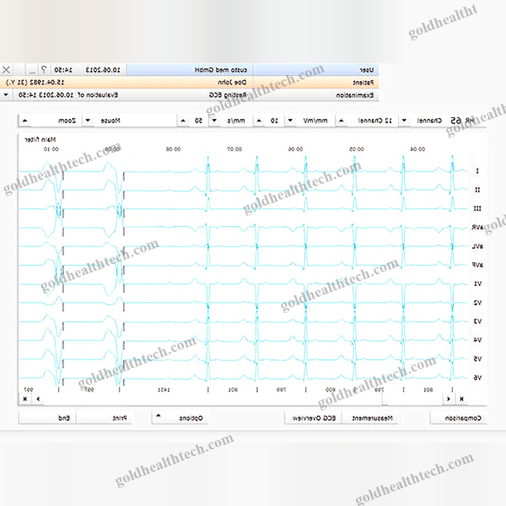 Electrocardiography Software Module
