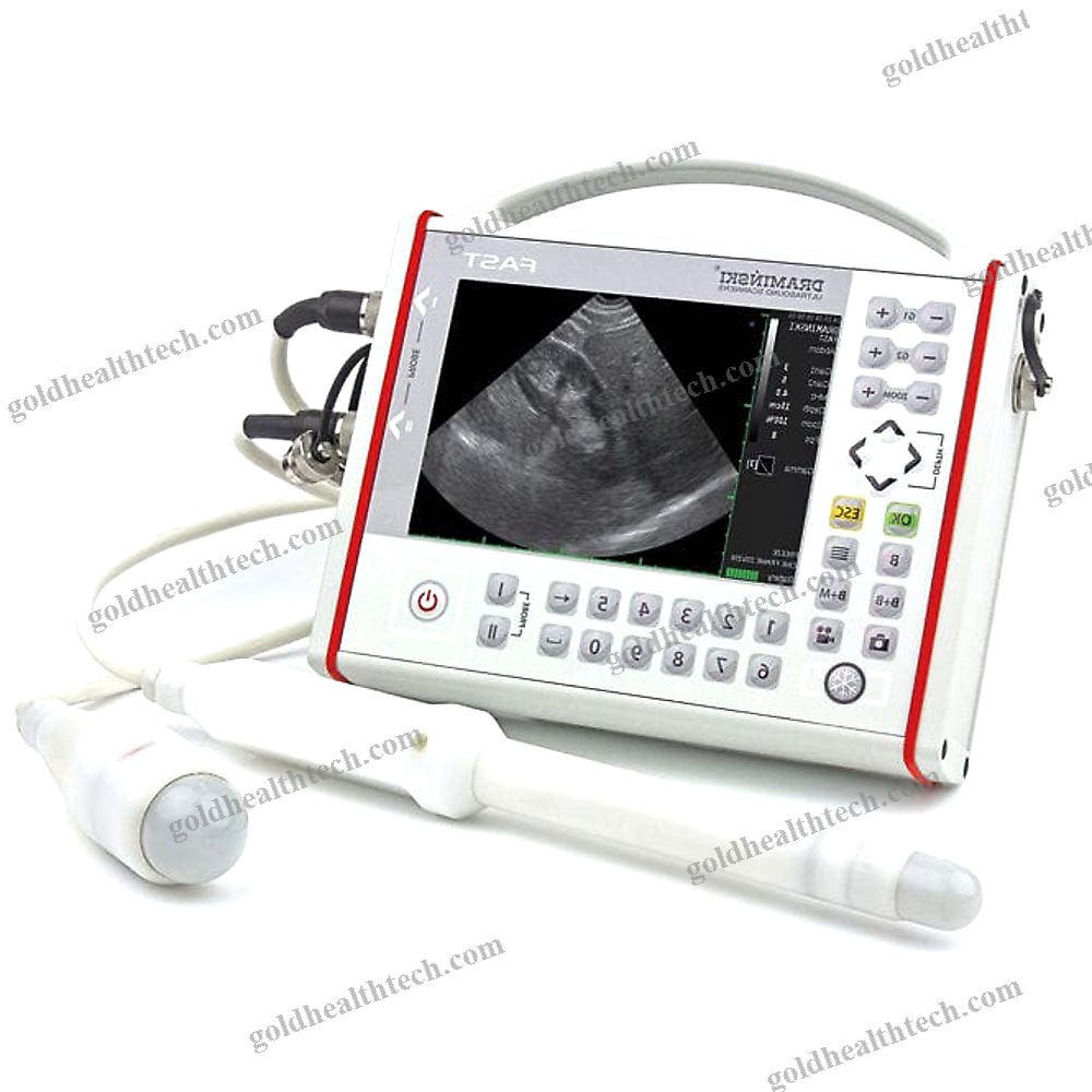 Portable Ultrasound System