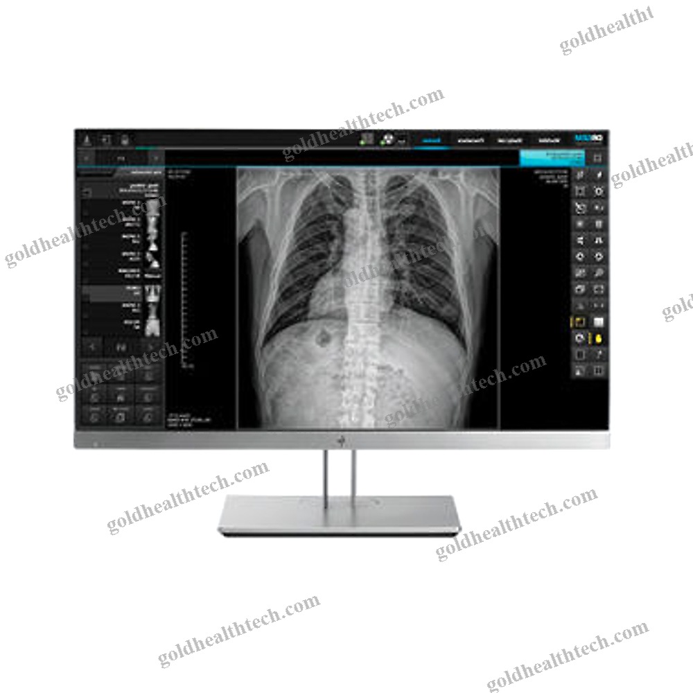 Radiography Acquisition System