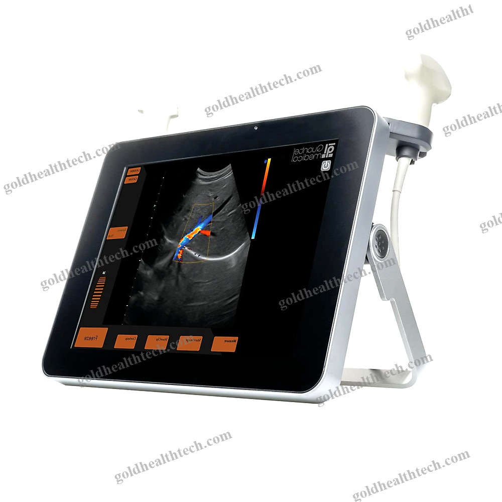 Portable Ultrasound System
