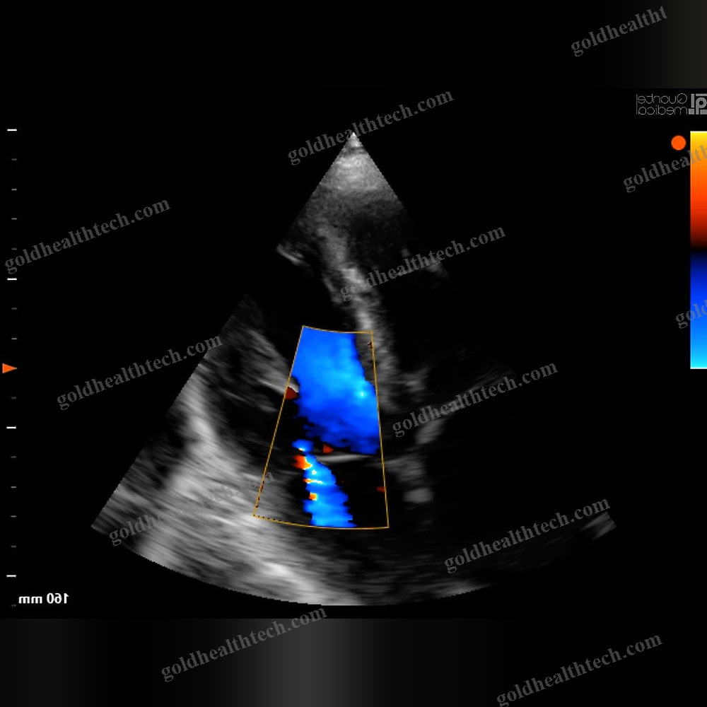 Portable Ultrasound System
