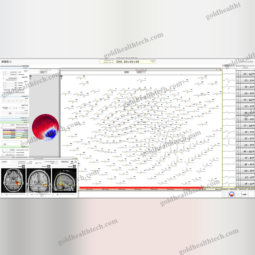 Eeg System With Mapping