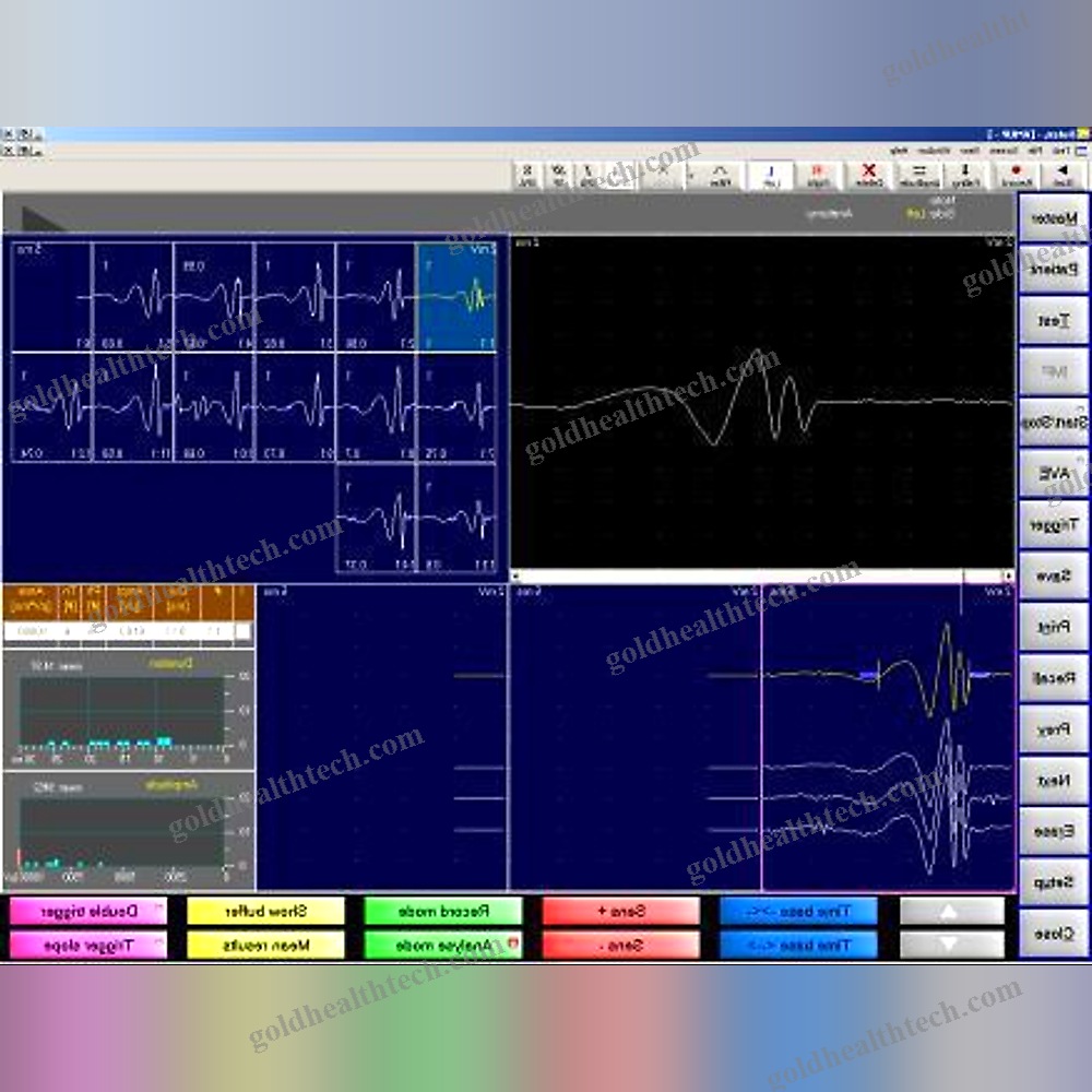 2-Channel Electromyograph
