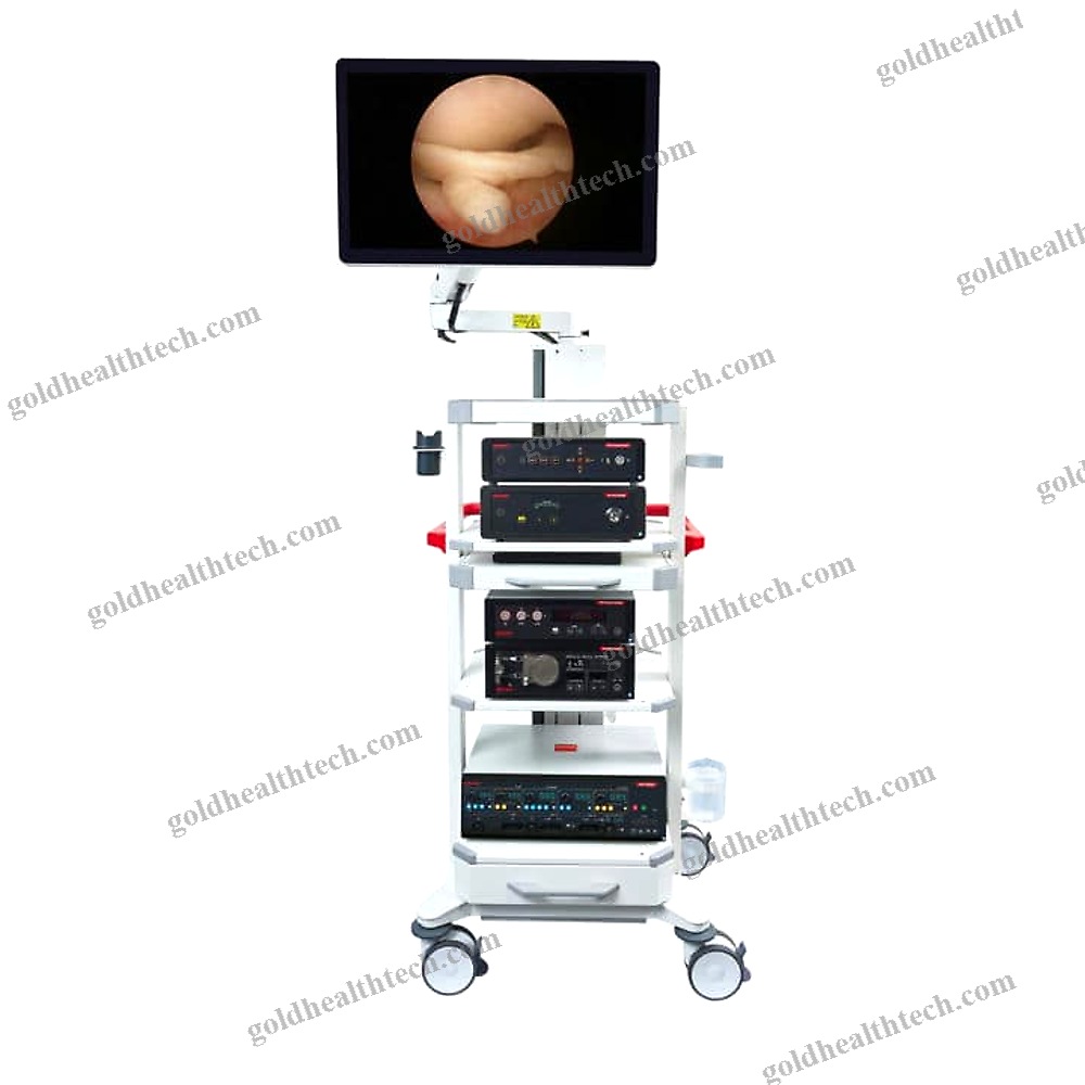 Arthroscopic Endoscopy Column