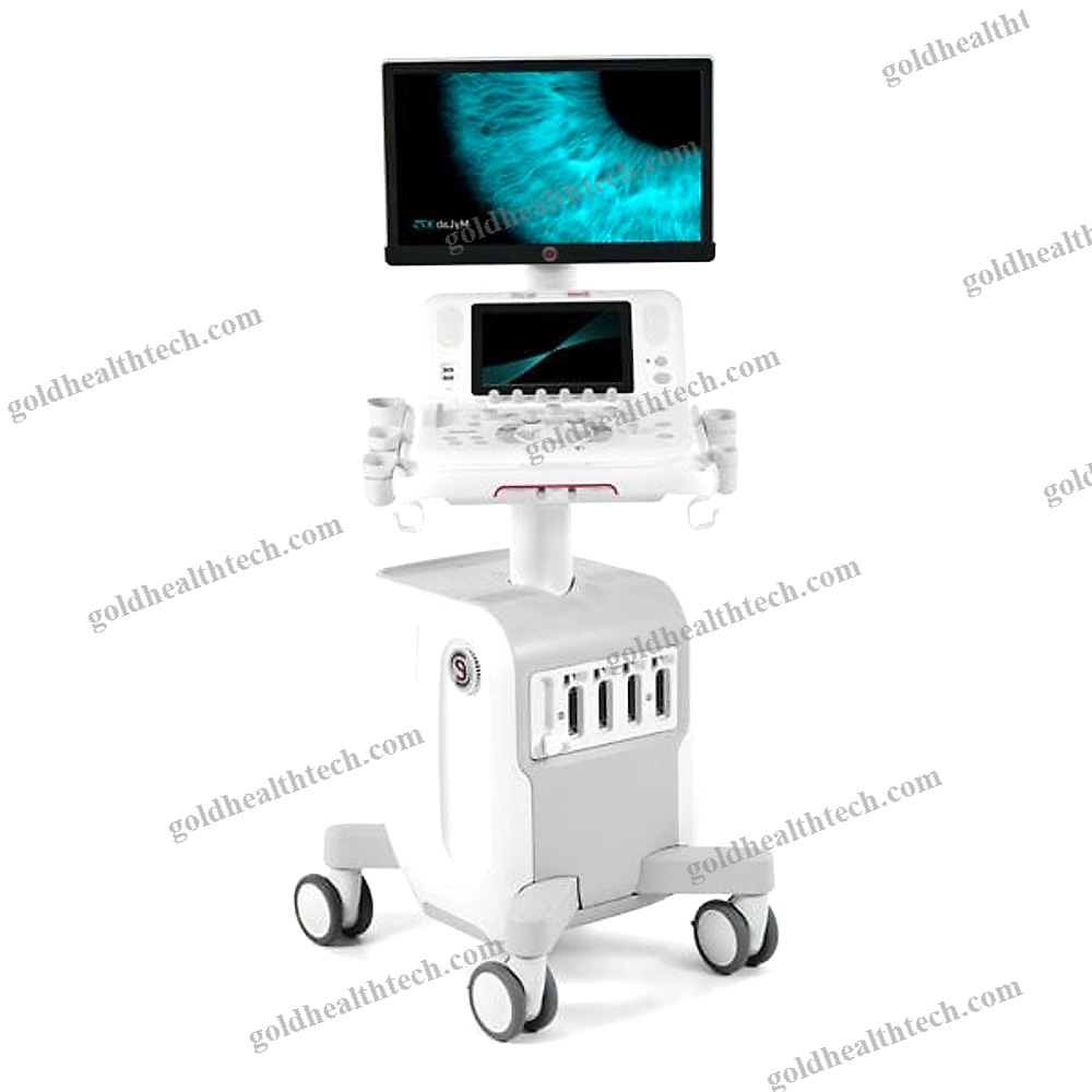 On-Platform Ultrasound System