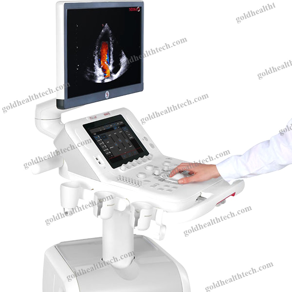 On-Platform Ultrasound System