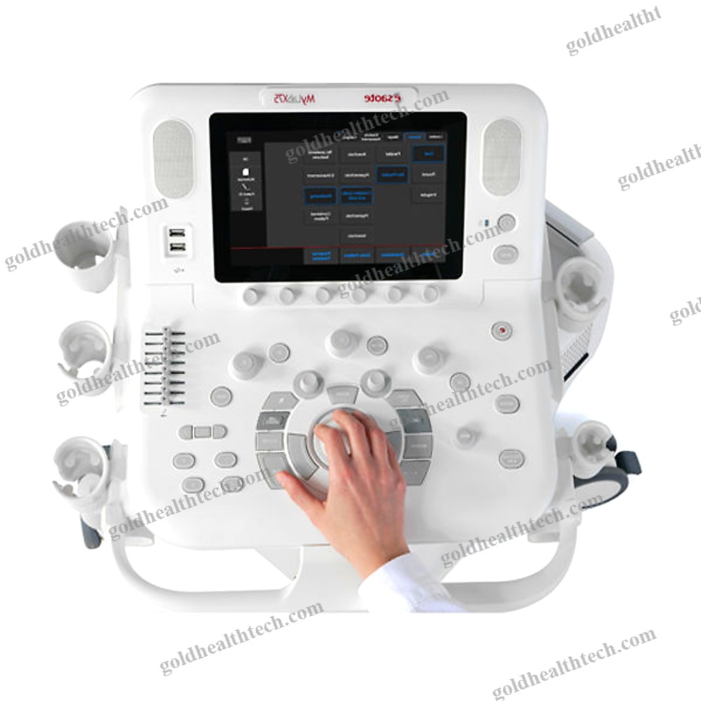 On-Platform Ultrasound System