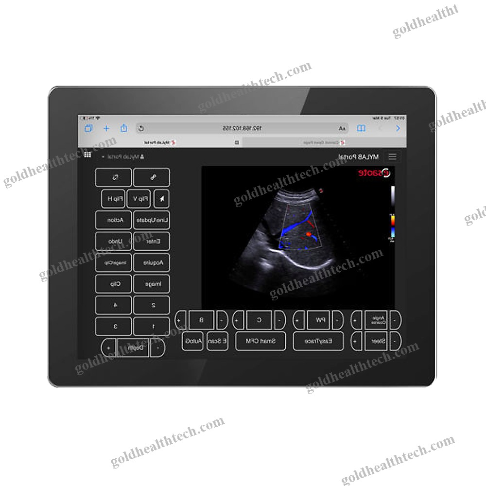 On-Platform Ultrasound System