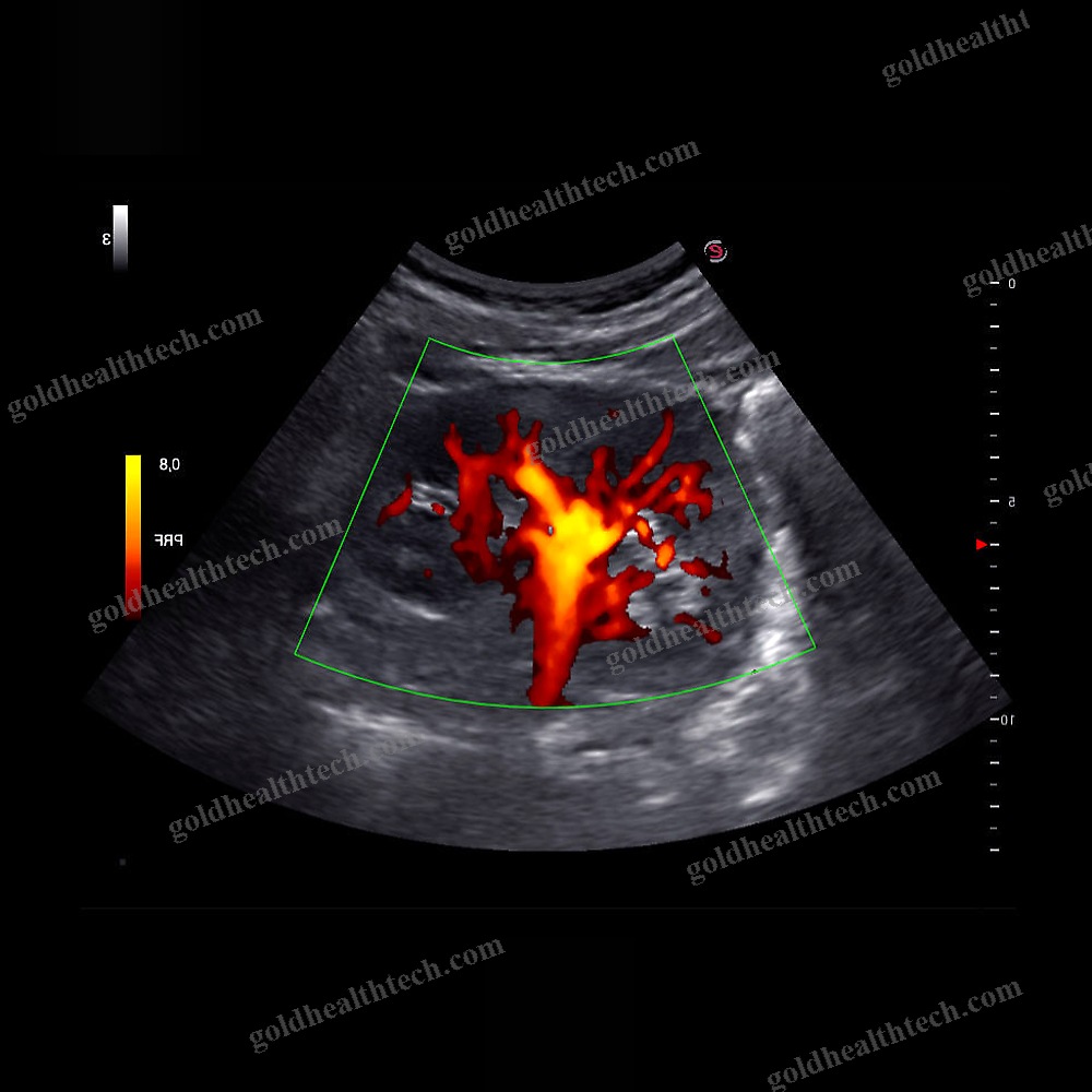 Hand-Held Ultrasound System