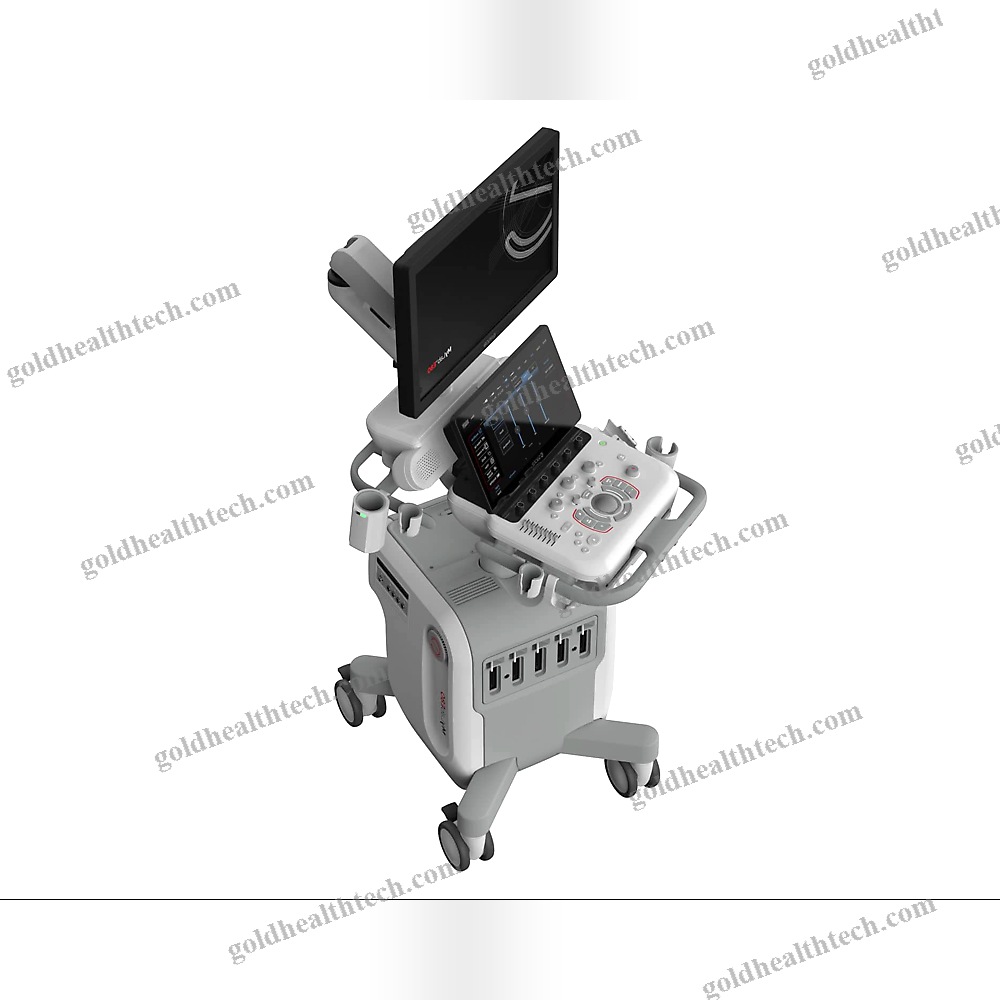 On-Platform Ultrasound System