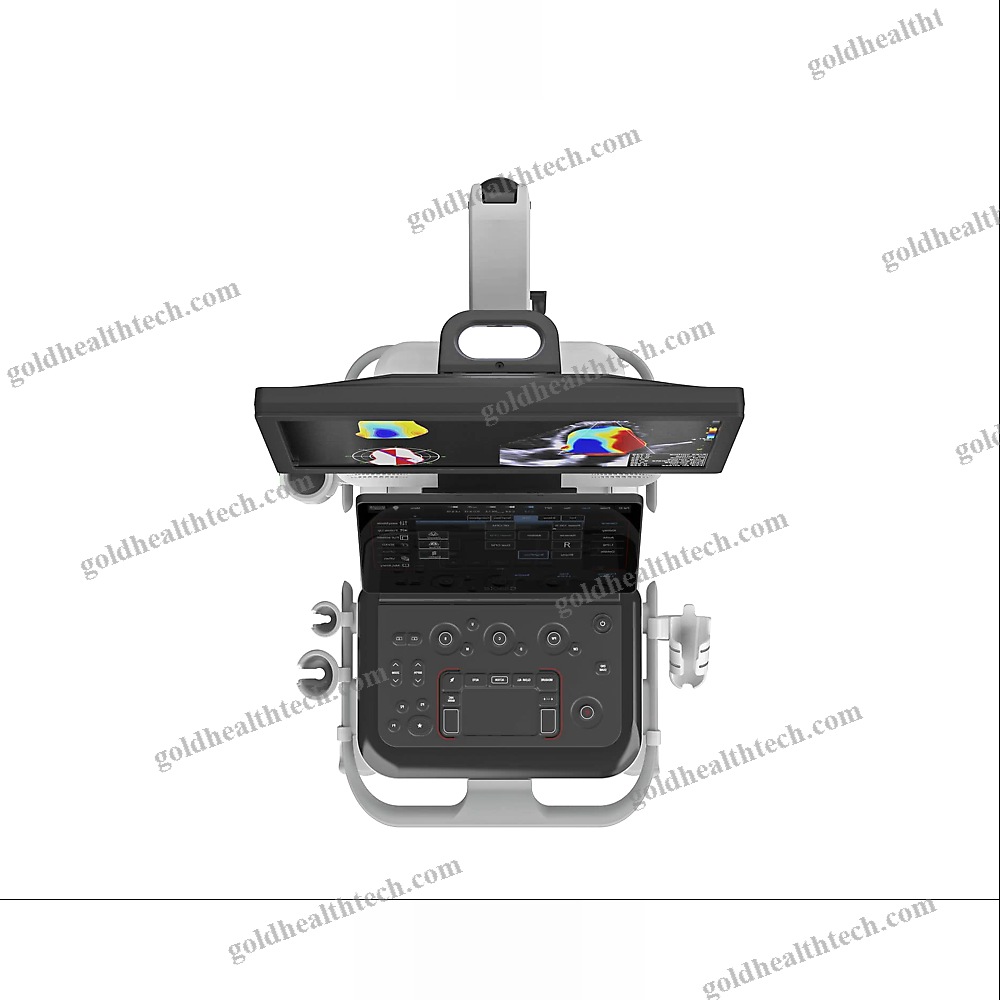 On-Platform Ultrasound System