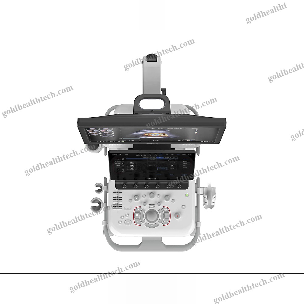 On-Platform Ultrasound System