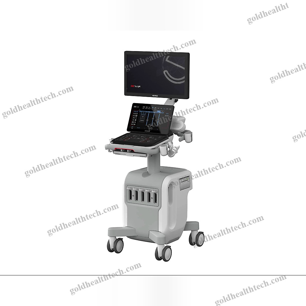 On-Platform Ultrasound System