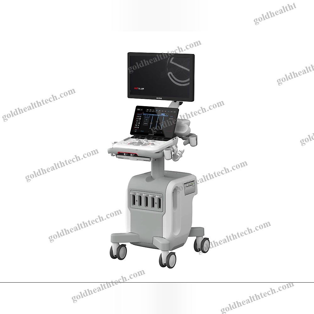 On-Platform Ultrasound System