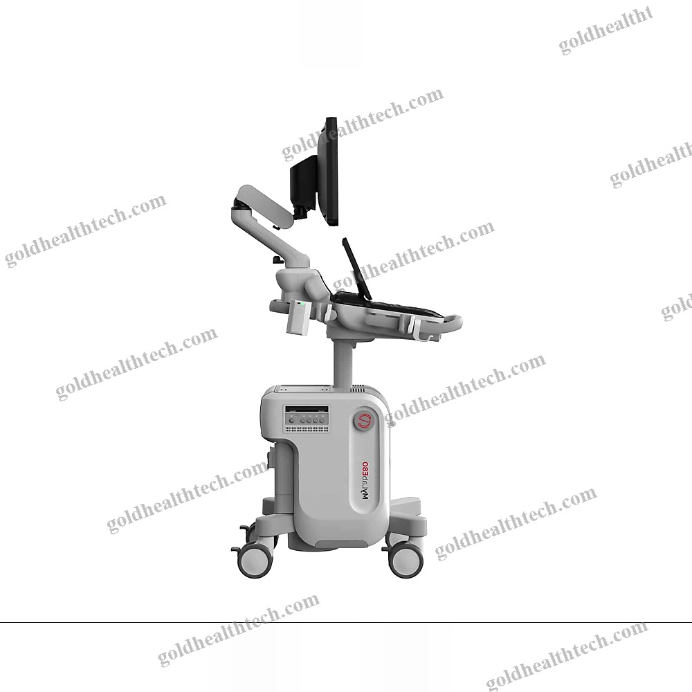 On-Platform Ultrasound System
