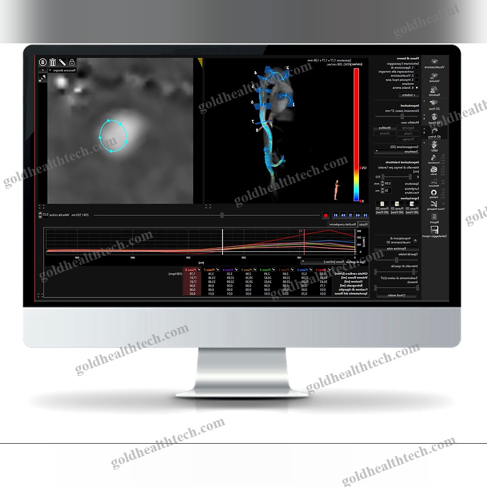 Mri Software