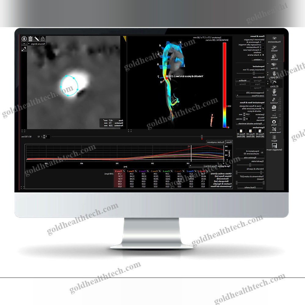 Mri Software