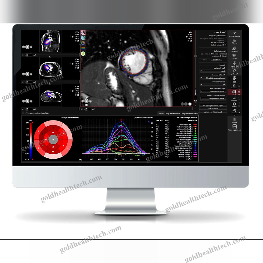 Mri Software