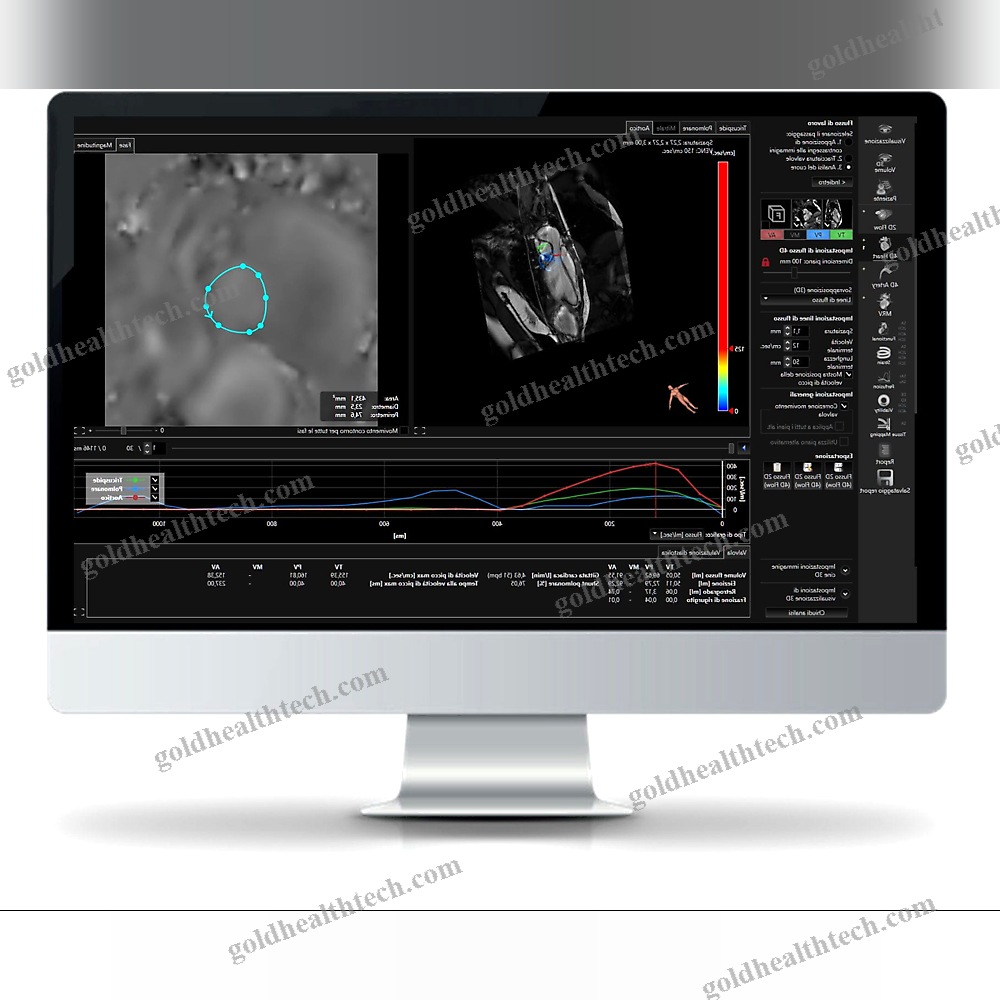 Mri Software