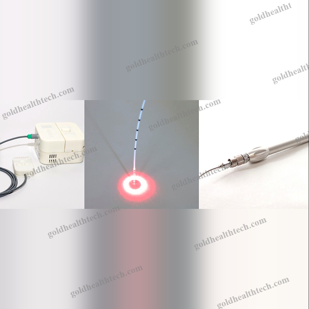 Dermatology Laser
