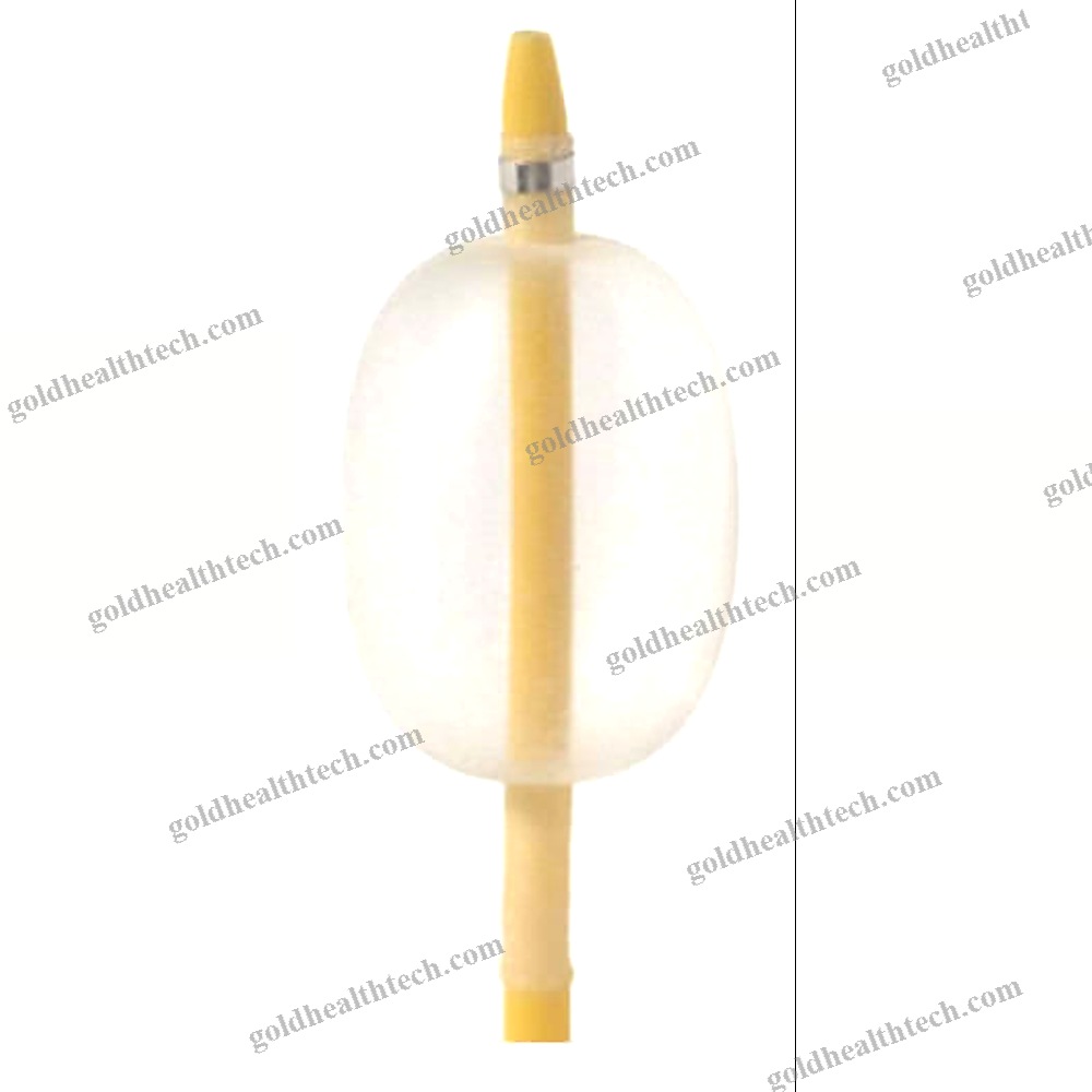 Stone Extraction Catheter