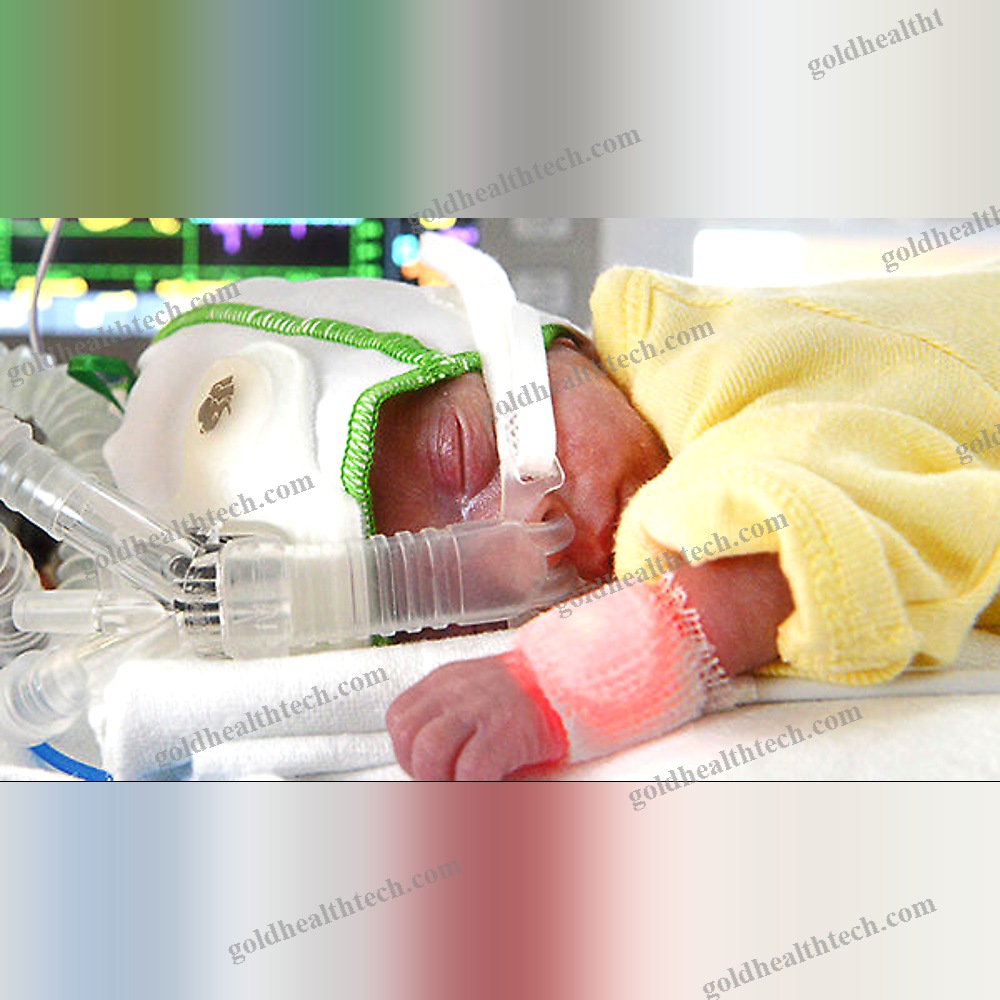 Resuscitation Ventilator