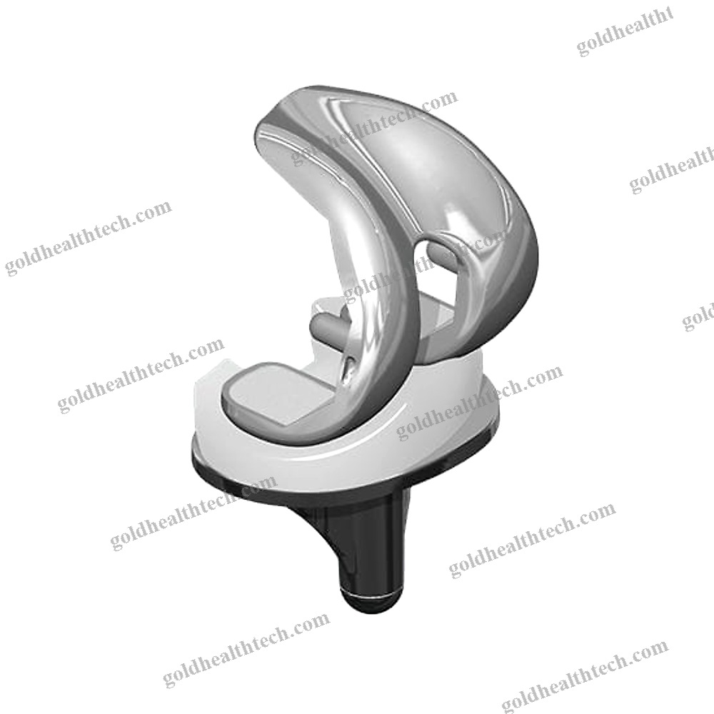 Three-Compartment Tibial Bearing