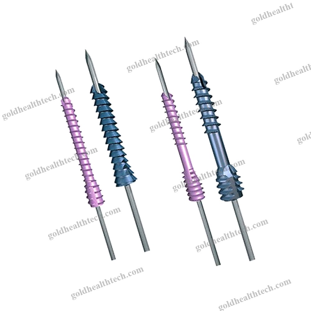 Hallux Valgus Arthrodesis Screw