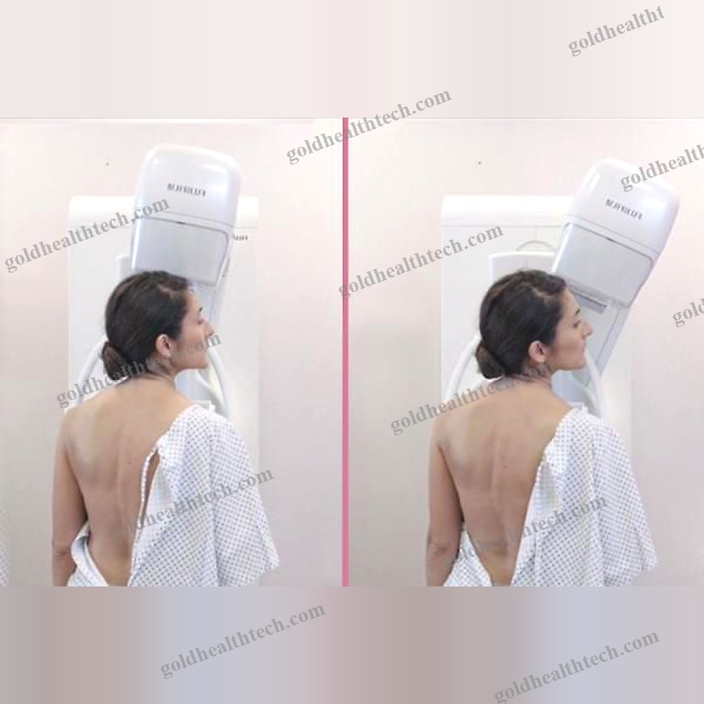 Digital Breast Tomosynthesis Mammography Unit