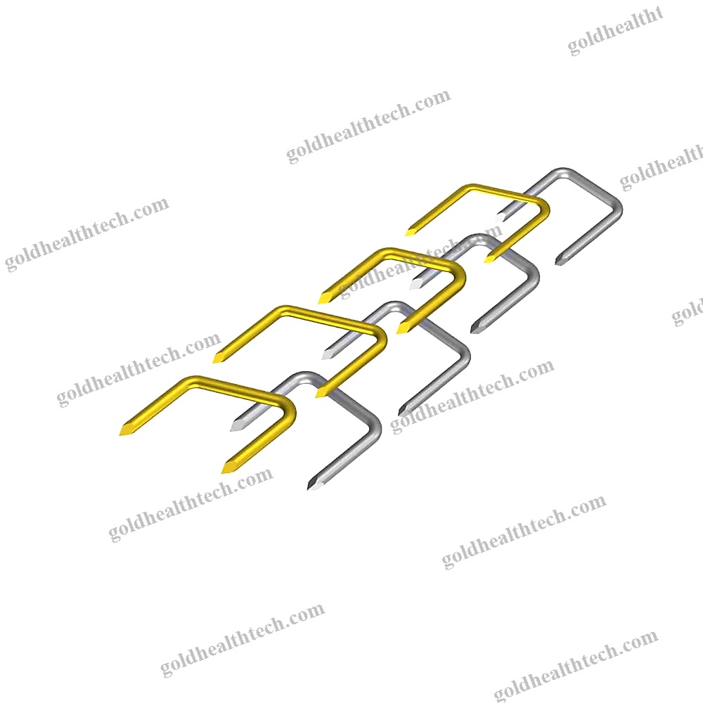 Akin Osteotomy Bone Staple