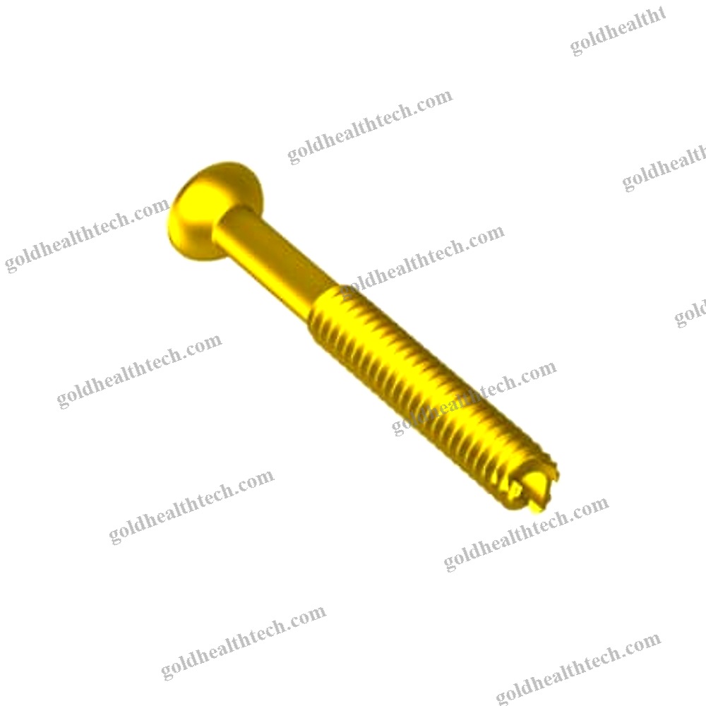 Arm Arthrodesis Screw