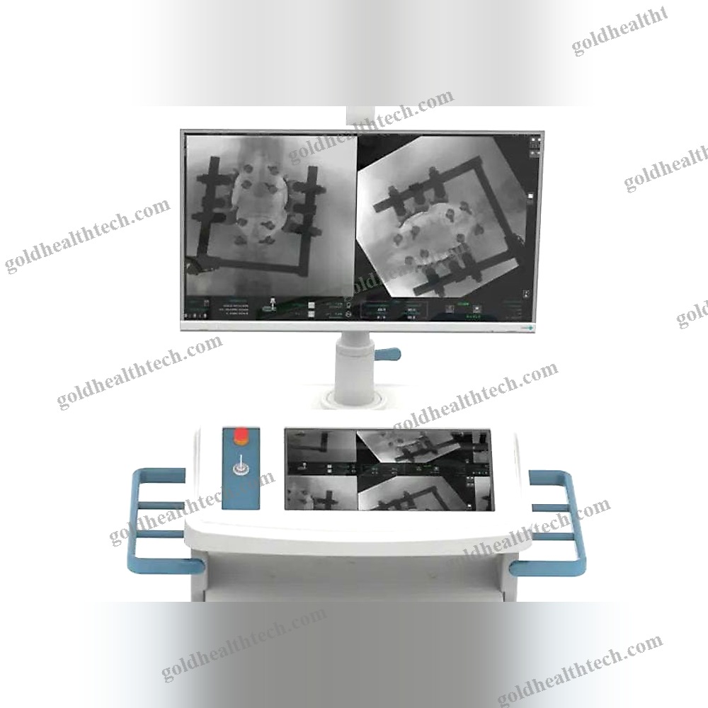Mobile C-Arm