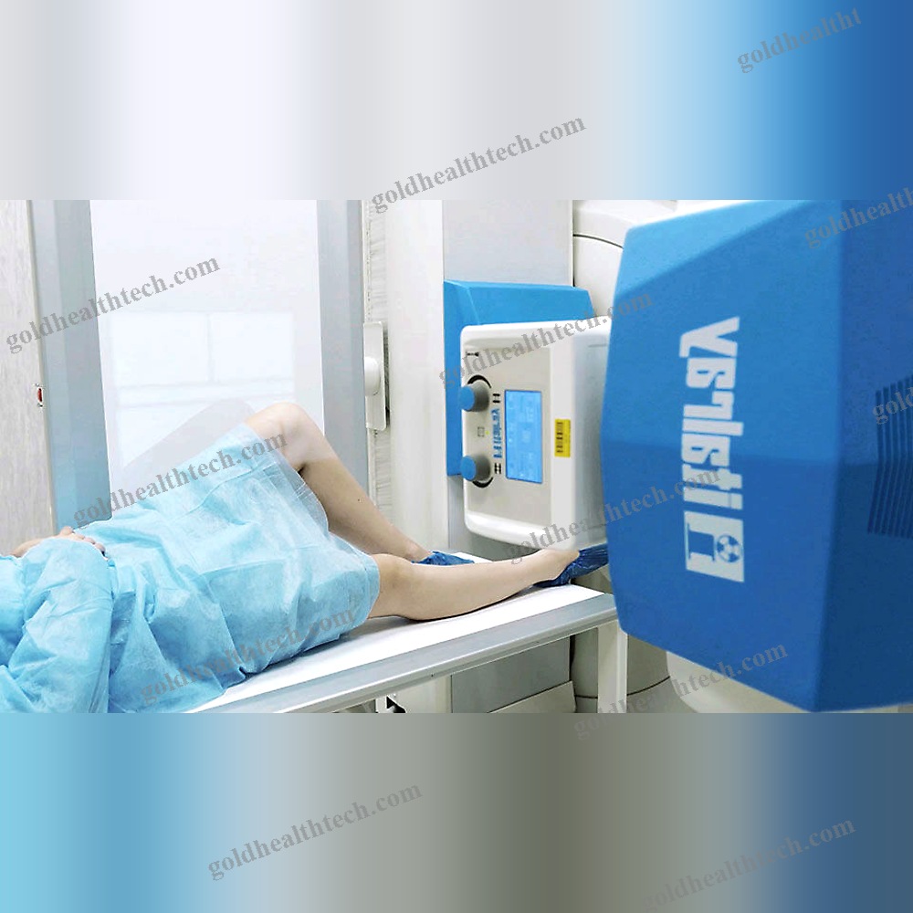 Radio-Fluoroscopy System