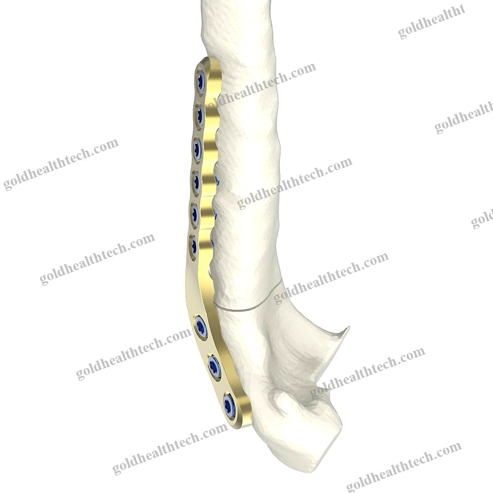 Knee Veterinary Osteotomy Plate