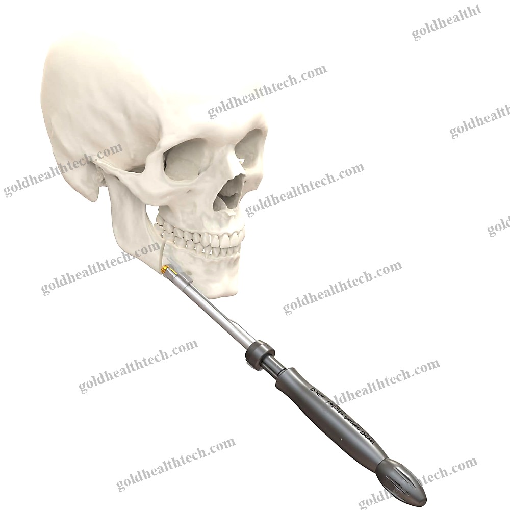 Manual Orthopedic Screwdriver