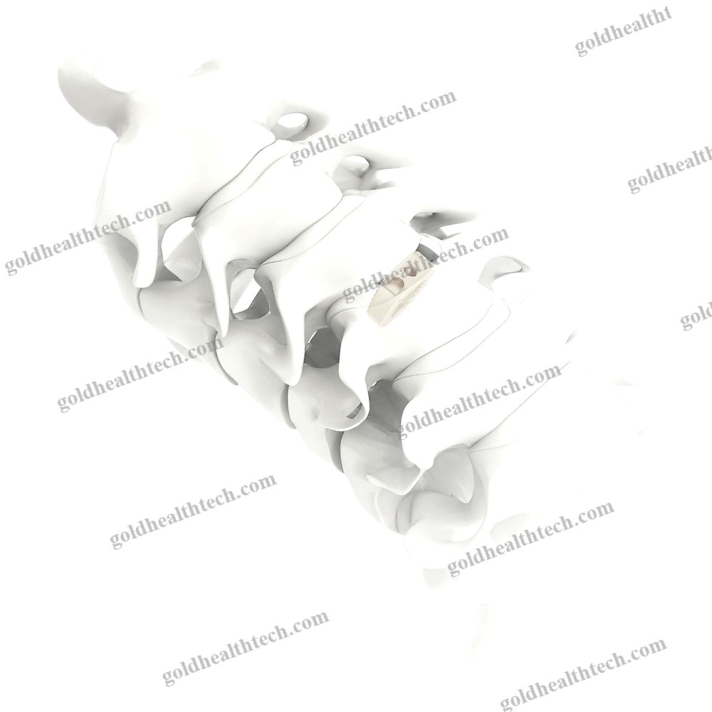 Cervical Interbody Fusion Cage