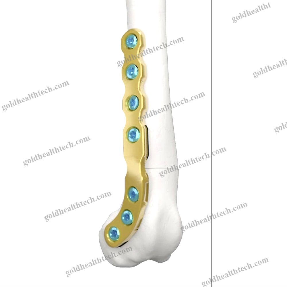 Knee Veterinary Osteotomy Plate
