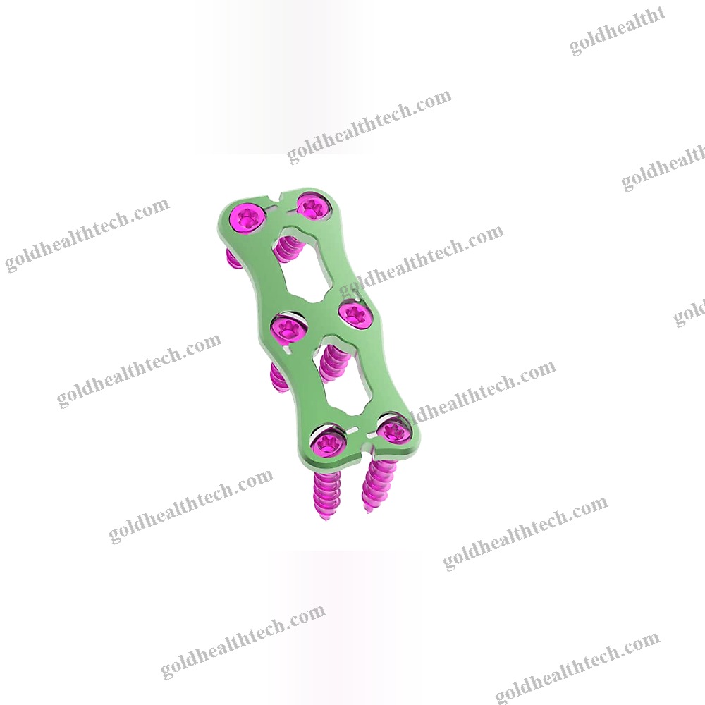 Cervical Arthrodesis Plate