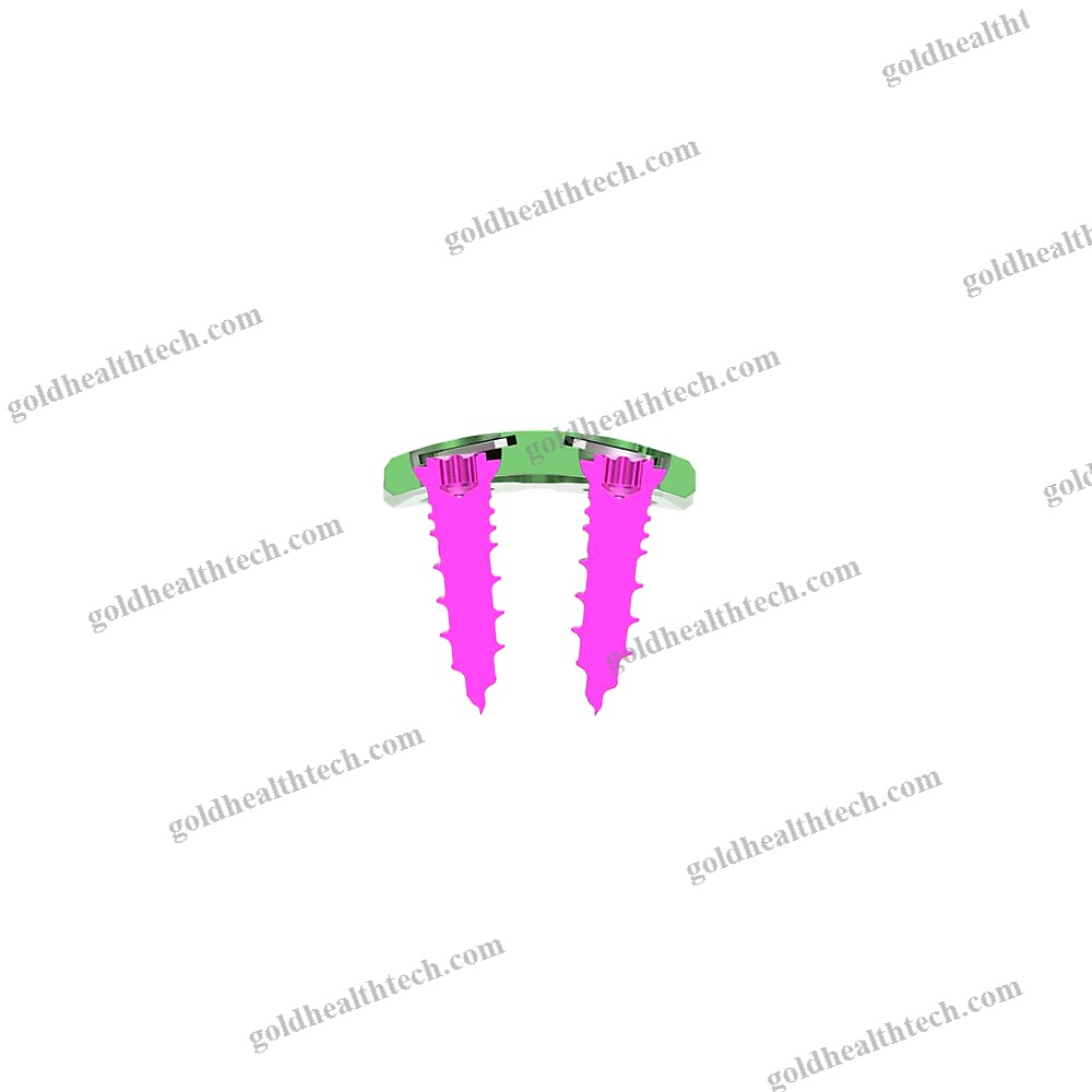 Cervical Arthrodesis Plate