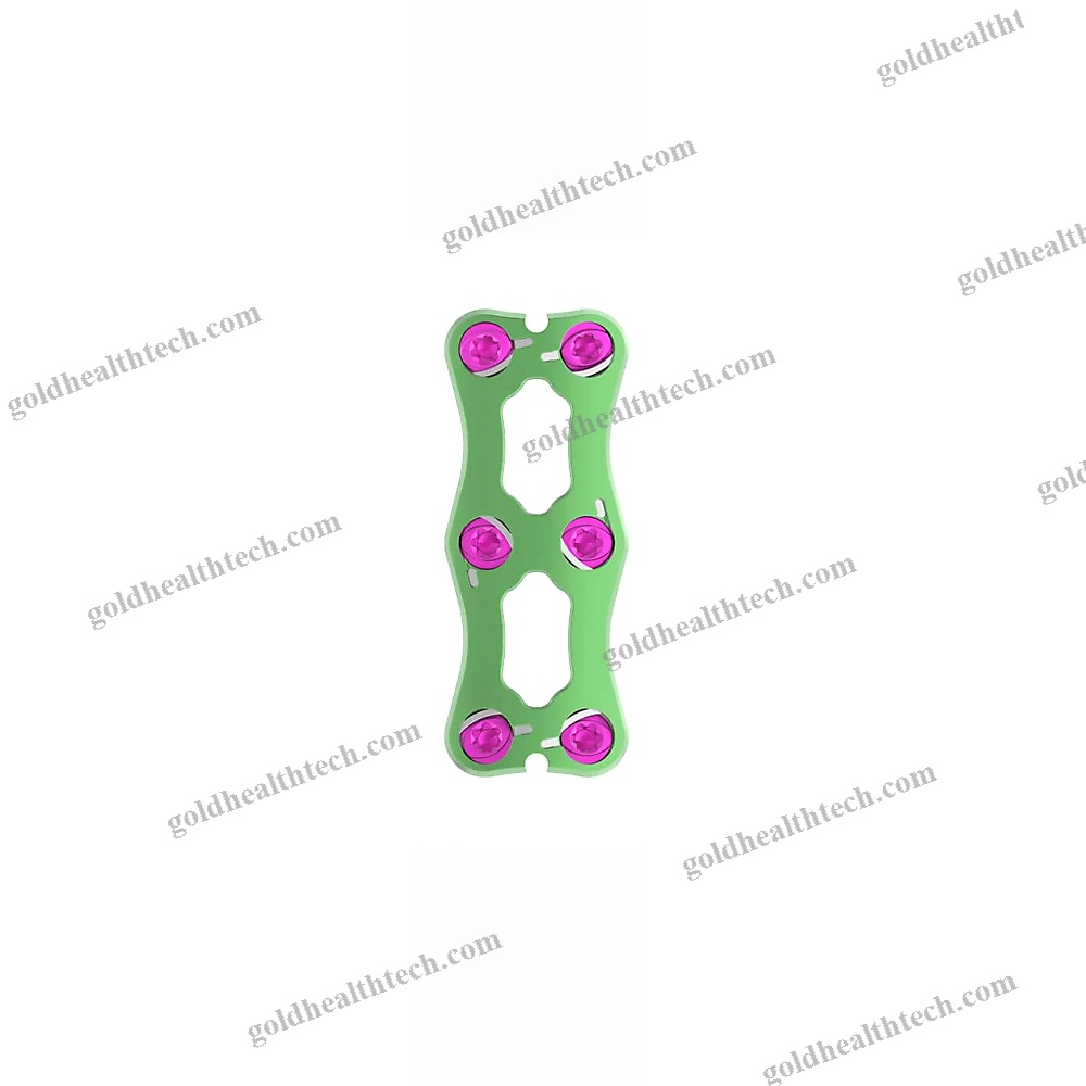 Cervical Arthrodesis Plate