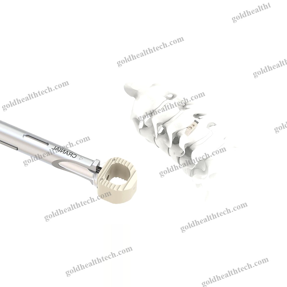 Cervical Interbody Fusion Cage