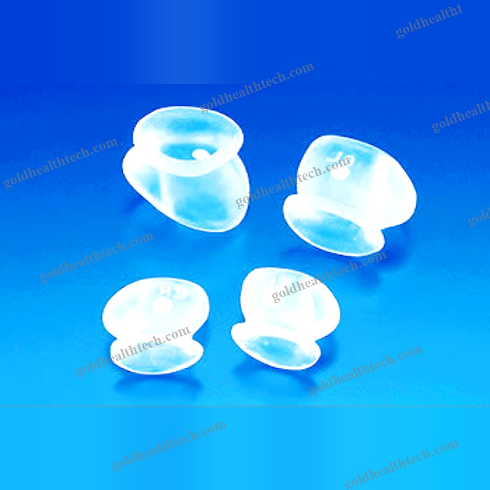 Nasal Implant
