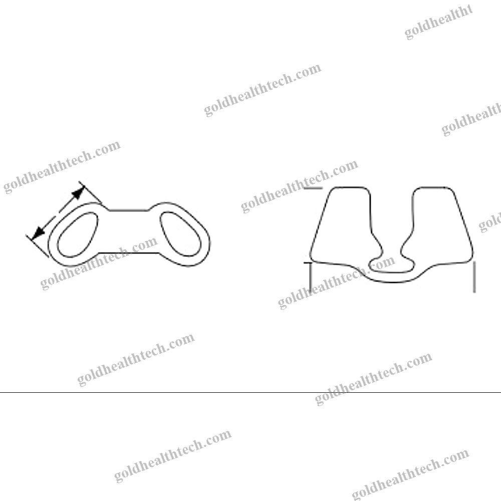 Nasal Implant