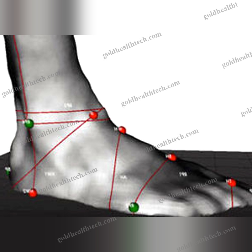 Gait Evaluation System