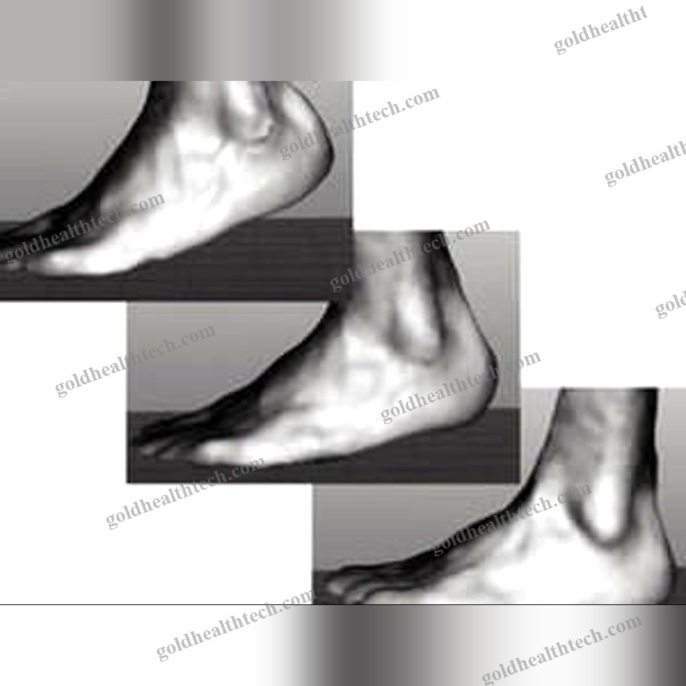 Gait Evaluation System