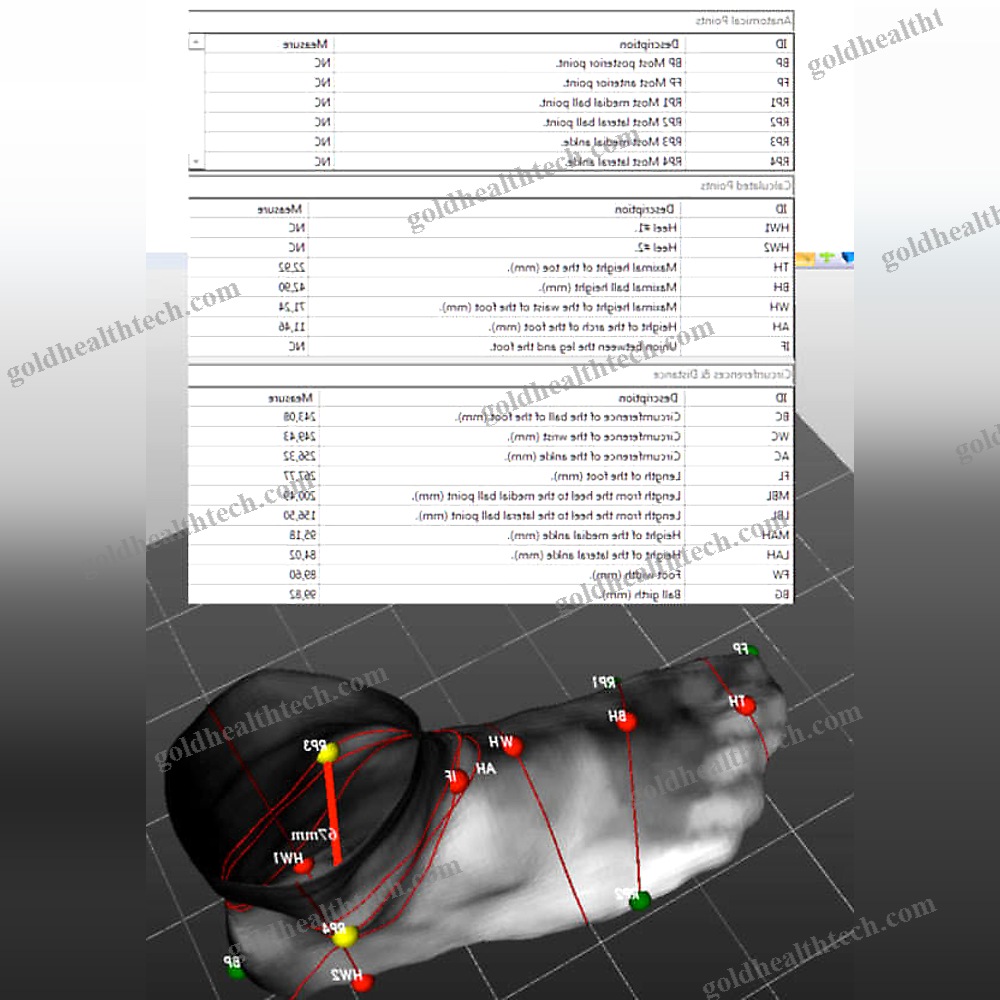 Gait Evaluation System