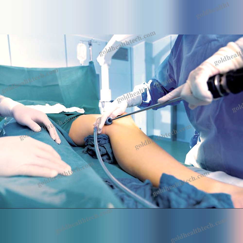 Radial Artery Harvesting Endoscopic Surgical System