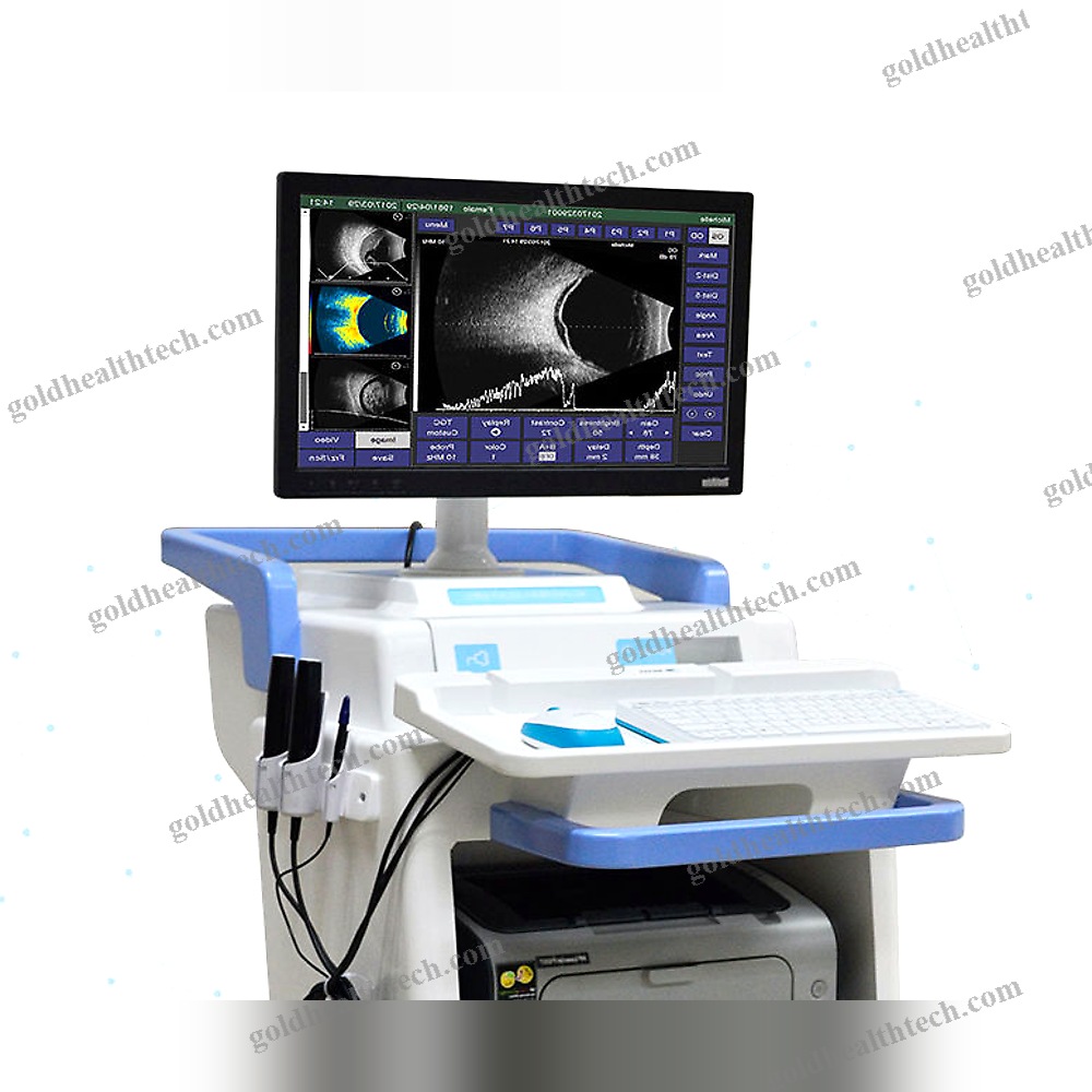 On-Platform Ultrasound System