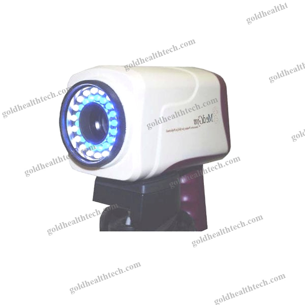 Video Colposcope