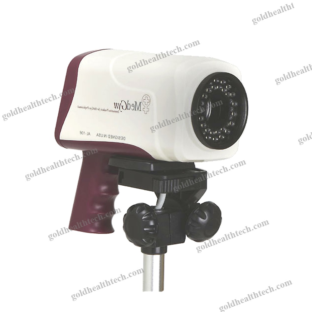 Video Colposcope